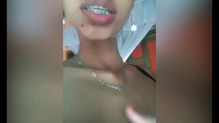 Thương hiệu mới âm hộ sưng